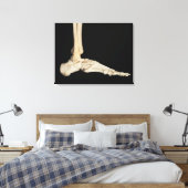 Toile Os du pied (Insitu(Chambre))