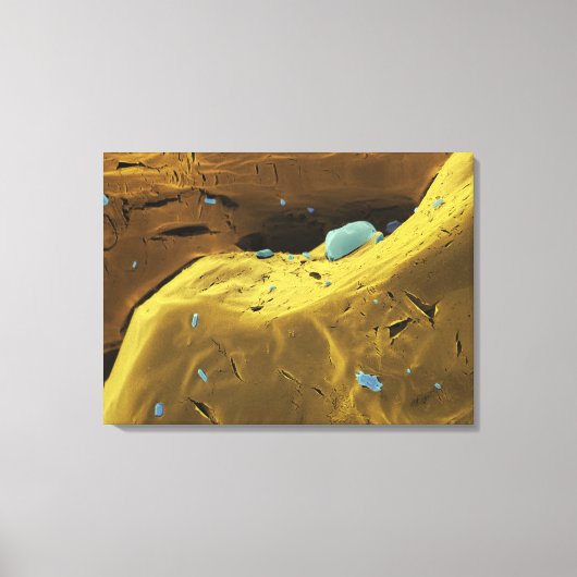 Toile Poudre d'urée (Recto)