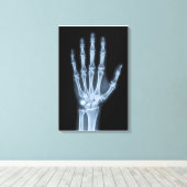 Toile Radiographie clinique de la main (Insitu (Plancher de Bois))