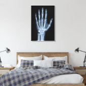Toile Radiographie clinique de la main (Insitu(Chambre))