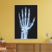 Toile Radiographie clinique de la main (Insitu(Salon))