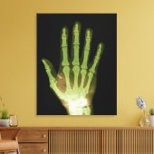 Toile Radiographie de la main humaine (Insitu(Salon))
