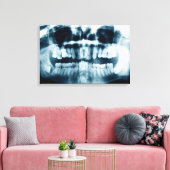 Toile Radiographie dentaire (Insitu(Salon))
