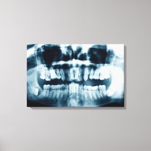 Toile Radiographie dentaire (Recto)