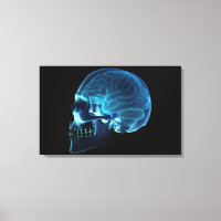 Radiographie du cerveau à l'intérieur d'un crâne