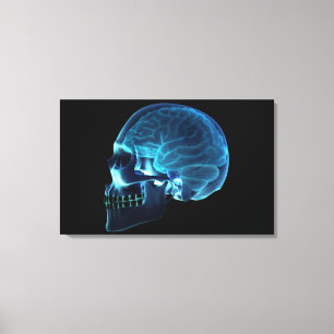 Toile Radiographie du cerveau à l'intérieur d'un crâne