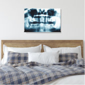 Toile Rayon X des dents (Insitu(Chambre))