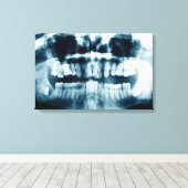 Toile Rayon X des dents (Insitu (Plancher de Bois))