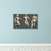 Toile Remplacement du gel de tueur (Insitu (Plancher de Bois))