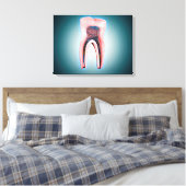 Toile Section D'Une Dent Humaine (Insitu(Chambre))