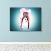 Toile Section D'Une Dent Humaine (Insitu (Plancher de Bois))