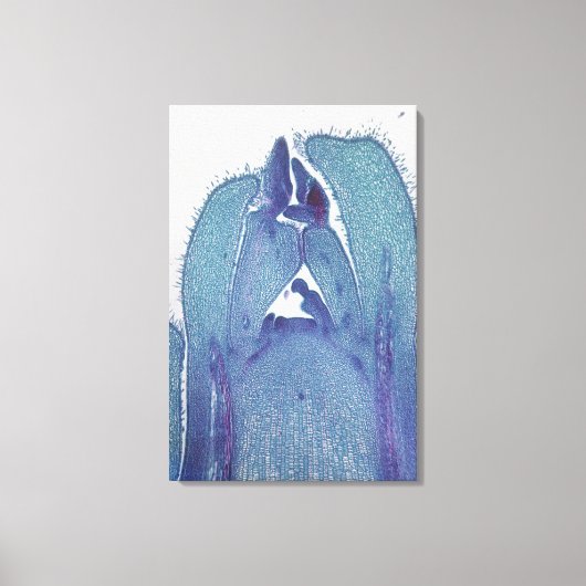 Toile Section longitudinale d'un bout de tige d'érable ( (Recto)