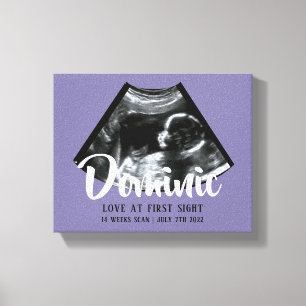 Toile Sonogramme Keepsaké Baby Ultrasound Canvas Imprim
