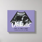 Toile Sonogramme Keepsaké Baby Ultrasound Canvas Imprime (Recto)