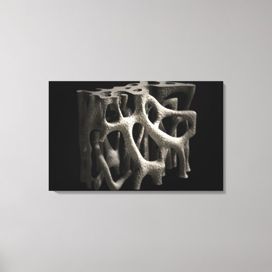 Toile Structure d'un os avec ostéoporose (Recto)