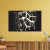 Toile Structure d'un os avec ostéoporose (Insitu(Salon))