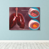 Toile Trachea Transsection Avec Poumons (Insitu (Plancher de Bois))