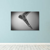 Toile Vue En Rayon X Du Pied Humain 4 (Insitu (Plancher de Bois))