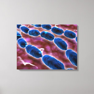 Toile Vue Microscopique De La Pneumonie Bactérienne 1