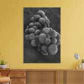 Toile Vue Microscopique De La Tumeur 1 (Insitu(Salon))