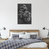 Toile Vue Microscopique De La Tumeur 1 (Insitu(Chambre))