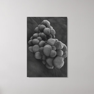 Toile Vue Microscopique De La Tumeur 1