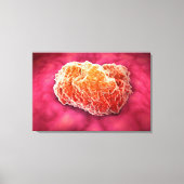 Toile Vue Microscopique De La Tumeur 3 (Recto)