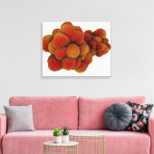 Toile Vue Microscopique De La Tumeur 4 (Insitu(Salon))
