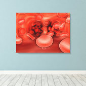 Toile Vue Microscopique Des Cellules De Sang Rouge Qui S (Insitu (Plancher de Bois))