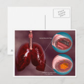 Trachea-doorsnede met longen briefkaart (Voorkant / Achterkant)