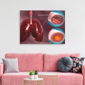 Trachea-doorsnede met longen canvas afdruk (Insitu (Woonkamer))