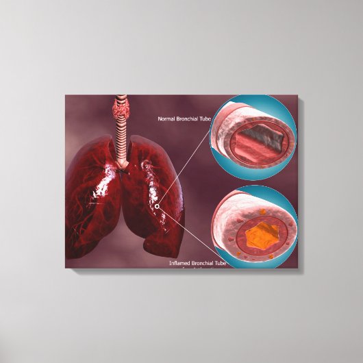Trachea-doorsnede met longen canvas afdruk (Voorkant)