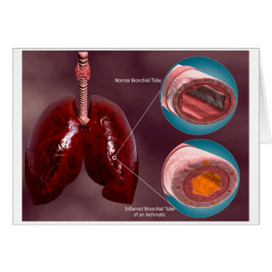 Trachea Transsection Avec Poumons