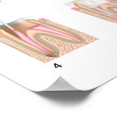 Traitement du canal racine Toute taille Poster (Coin)