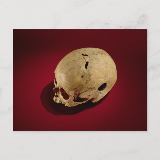 Trepaned Skull Briefkaart (Voorkant)