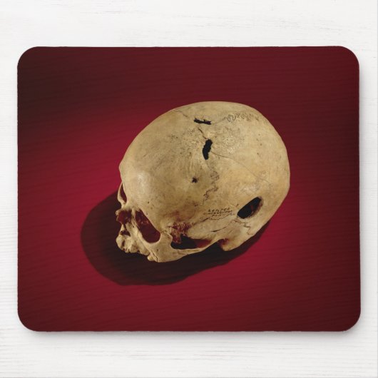Trepaned Skull Muismat (Voorkant)