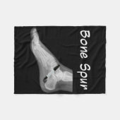 Trump Bone Spur Ink Pen Funny Anti Trump  Fleece Deken (Voorkant (Horizontaal))