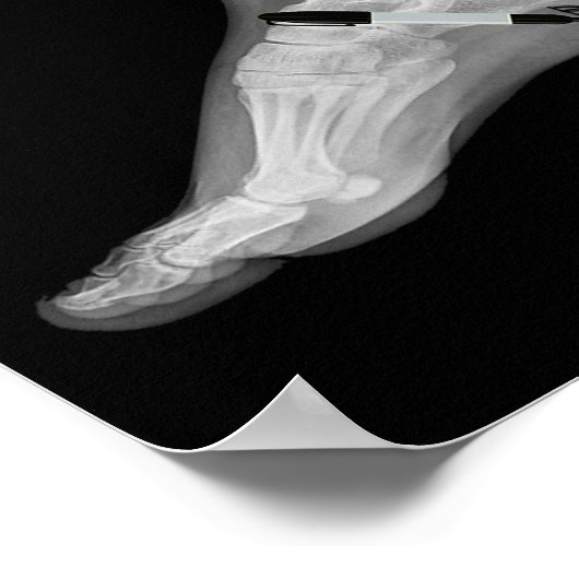 Trump Bone Spur Ink Pen Grappig Anti Trump Poster (Hoek)