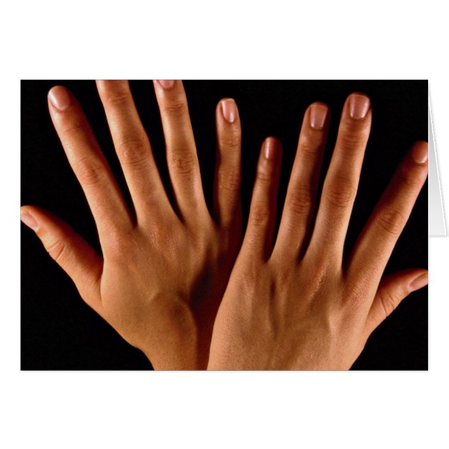 Twee gekruiste handen (Voorkant Horizontaal)