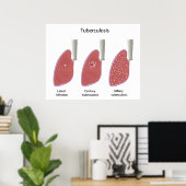 Types de tuberculose Poster (Bureau à domicile)