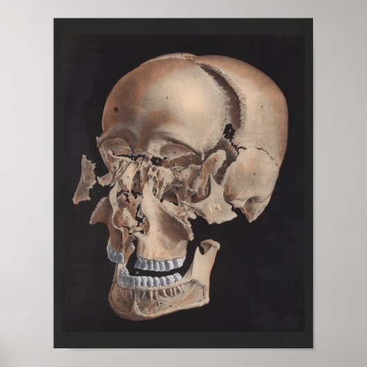 Uitgebreide huidafdruk poster (Voorkant)