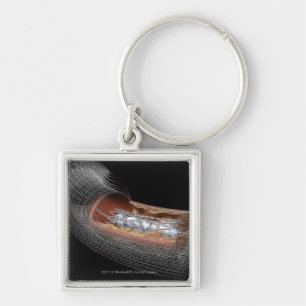 Uitzicht van een angioplatieballon in een slagader sleutelhanger