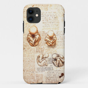 Uitzichten van een foetus in de baarmoeder, Ob-Gyn iPhone 11 Hoesje
