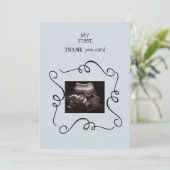 Ultrasons lunaires Merci Baby Point de vue (Debout devant)