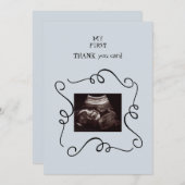 Ultrasons lunaires Merci Baby Point de vue (Devant / Derrière)