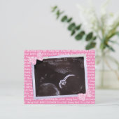 Ultrasound Afbeelding Baby shower Uitnodiging Brie (Staand voorkant)