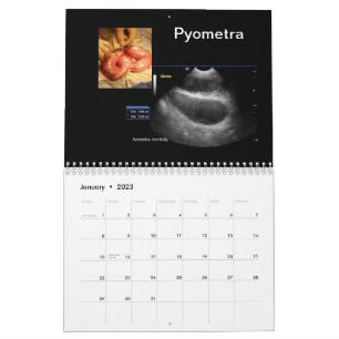 Ultrasound Afbeeldingen Agenda Kalender