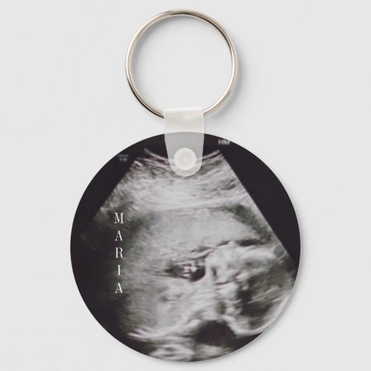 Ultrasound baby keepomwille sleutelhanger (Voorkant)
