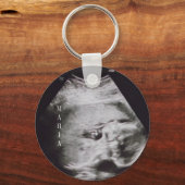 Ultrasound baby keepomwille sleutelhanger (Voorkant)