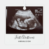 Ultrasound eerste kerstfeestdag metalen ornament (Achterkant)